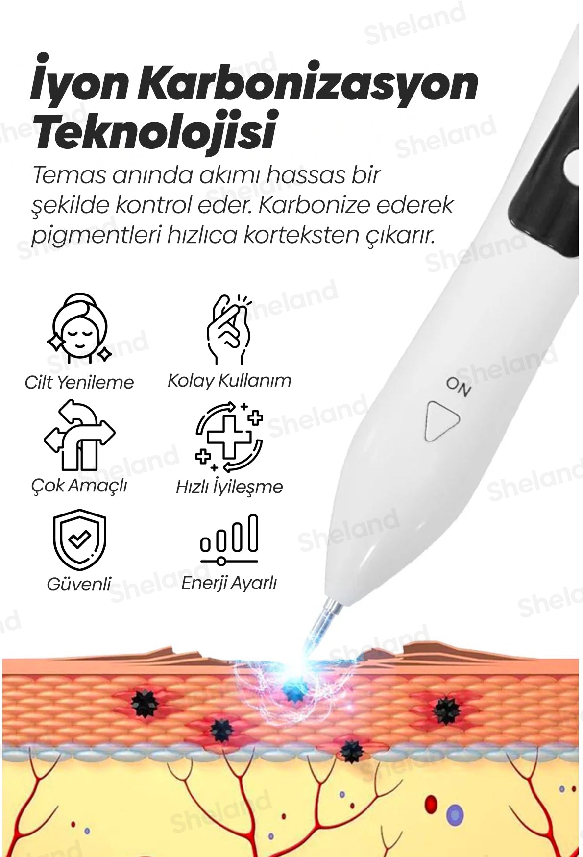 Mole Plazma Pen Akne, Yara Izi, Ben, Dövme, Siğil, Çatlak, Leke Silme ve Cilt Bakım